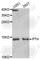 Parathyroid Hormone antibody, A5846, ABclonal Technology, Western Blot image 