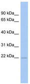 RWD Domain Containing 4 antibody, TA337875, Origene, Western Blot image 