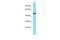 Cytokine-dependent hematopoietic cell linker antibody, PA5-70682, Invitrogen Antibodies, Western Blot image 