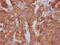 CD46 Molecule antibody, CSB-RA908548A0HU, Cusabio, Immunohistochemistry paraffin image 