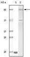 TYRO3 Protein Tyrosine Kinase antibody, M00913, Boster Biological Technology, Western Blot image 