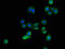 Aldehyde Dehydrogenase 1 Family Member A3 antibody, LS-C498339, Lifespan Biosciences, Immunofluorescence image 