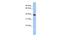 Tetraspanin 17 antibody, A14849, Boster Biological Technology, Western Blot image 