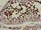 Lanosterol 14-alpha demethylase antibody, CSB-PA614993LA01HU, Cusabio, Immunohistochemistry frozen image 
