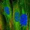 Murine Retrovirus Integration Site 1 Homolog antibody, HPA008704, Atlas Antibodies, Immunofluorescence image 