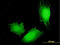 MAGE Family Member A4 antibody, LS-C197642, Lifespan Biosciences, Immunofluorescence image 