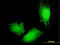 MAGE-X2 antigen antibody, LS-C197642, Lifespan Biosciences, Immunofluorescence image 