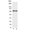 Netrin 1 antibody, R30747, NSJ Bioreagents, Western Blot image 