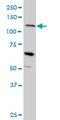 Mucin-4 antibody, LS-C104999, Lifespan Biosciences, Western Blot image 