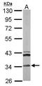 Enoyl-CoA Hydratase 1 antibody, GTX114374, GeneTex, Western Blot image 