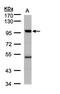 Lysine Acetyltransferase 2B antibody, LS-C186090, Lifespan Biosciences, Western Blot image 