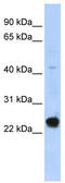 Cilia And Flagella Associated Protein 20 antibody, TA335647, Origene, Western Blot image 