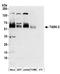 Potassium Two Pore Domain Channel Subfamily K Member 5 antibody, A304-447A, Bethyl Labs, Western Blot image 