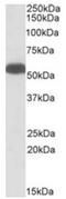 Glutamate dehydrogenase 1, mitochondrial antibody, AP23724PU-N, Origene, Western Blot image 