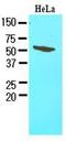 FKBP Prolyl Isomerase 4 antibody, GTX53715, GeneTex, Western Blot image 