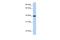 Retinol Dehydrogenase 11 antibody, A06946, Boster Biological Technology, Western Blot image 
