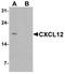 Stromal cell-derived factor 1 antibody, TA326687, Origene, Western Blot image 