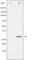 Snail Family Transcriptional Repressor 1 antibody, abx012240, Abbexa, Western Blot image 
