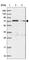 Tetratricopeptide Repeat Domain 12 antibody, HPA038543, Atlas Antibodies, Western Blot image 