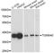 Translocase Of Outer Mitochondrial Membrane 40 antibody, A3213, ABclonal Technology, Western Blot image 