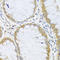 ADP Ribosylation Factor Like GTPase 6 antibody, A05003, Boster Biological Technology, Immunohistochemistry frozen image 