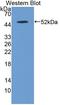 Inosine Triphosphatase antibody, LS-C372991, Lifespan Biosciences, Western Blot image 