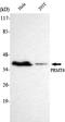 Protein Arginine Methyltransferase 6 antibody, M02924-1, Boster Biological Technology, Western Blot image 