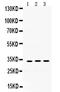 Superoxide Dismutase 3 antibody, PB9747, Boster Biological Technology, Western Blot image 