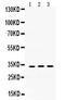 SOD3 antibody, PB9747, Boster Biological Technology, Western Blot image 