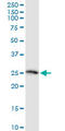 Twisted Gastrulation BMP Signaling Modulator 1 antibody, LS-B10447, Lifespan Biosciences, Western Blot image 