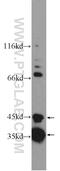 Sarcolemma Associated Protein antibody, 25220-1-AP, Proteintech Group, Western Blot image 