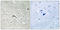 Fms Related Tyrosine Kinase 1 antibody, LS-C118327, Lifespan Biosciences, Immunohistochemistry paraffin image 