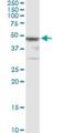 Homogentisate 1,2-Dioxygenase antibody, H00003081-M09, Novus Biologicals, Immunoprecipitation image 