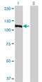 E4F Transcription Factor 1 antibody, LS-B11071, Lifespan Biosciences, Western Blot image 