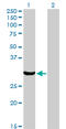 Protein Activator Of Interferon Induced Protein Kinase EIF2AK2 antibody, LS-B5437, Lifespan Biosciences, Western Blot image 