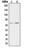 Testis Associated Actin Remodelling Kinase 1 antibody, MBS820650, MyBioSource, Western Blot image 