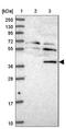 TRNA-YW Synthesizing Protein 5 antibody, NBP1-94109, Novus Biologicals, Western Blot image 