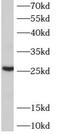 ADP Ribosylation Factor Like GTPase 6 Interacting Protein 6 antibody, FNab00580, FineTest, Western Blot image 