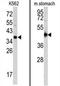 Cathepsin E antibody, AP17256PU-N, Origene, Western Blot image 