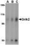 Glutamate Ionotropic Receptor Kainate Type Subunit 2 antibody, LS-C53225, Lifespan Biosciences, Western Blot image 