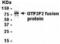 General Transcription Factor IIF Subunit 2 antibody, XW-7953, ProSci, Western Blot image 