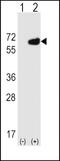 5'-Nucleotidase Ecto antibody, PA5-11871, Invitrogen Antibodies, Western Blot image 