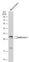 Kallikrein Related Peptidase 7 antibody, GTX100700, GeneTex, Western Blot image 