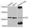 Angiotensin I Converting Enzyme antibody, A2805, ABclonal Technology, Western Blot image 