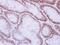 RAD50 Double Strand Break Repair Protein antibody, GTX119732, GeneTex, Immunohistochemistry paraffin image 