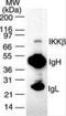Inhibitor Of Nuclear Factor Kappa B Kinase Subunit Beta antibody, GTX12140, GeneTex, Immunoprecipitation image 