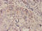 Macrophage Migration Inhibitory Factor antibody, LS-C104992, Lifespan Biosciences, Immunohistochemistry frozen image 