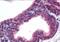 RAC-gamma serine/threonine-protein kinase antibody, NB100-1480, Novus Biologicals, Immunohistochemistry paraffin image 