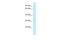 Solute Carrier Family 25 Member 15 antibody, A06413, Boster Biological Technology, Western Blot image 