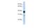 Nudix Hydrolase 18 antibody, GTX46167, GeneTex, Western Blot image 